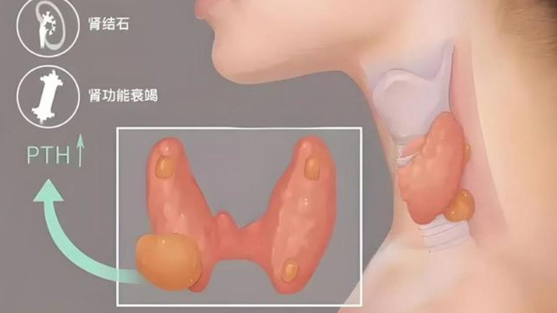 Etelcalcetide healthy | Shaanxi BLOOM Tech Co., Ltd Etelcalcetide healthy | Shaanxi BLOOM Tech Co., Ltd